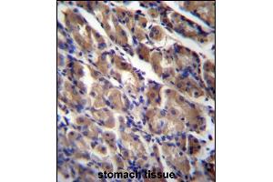 ABRA Antibody (C-term) (ABIN656755 and ABIN2845977) immunohistochemistry analysis in formalin fixed and paraffin embedded human stomach tissue followed by peroxidase conjugation of the secondary antibody and DAB staining. (ABRA antibody  (C-Term))