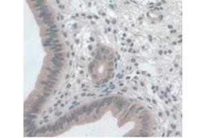 Detection of MCP1 in Mouse Uterus Tissue using Monoclonal Antibody to Monocyte Chemotactic Protein 1 (MCP1) (CCL2 antibody  (AA 24-96))