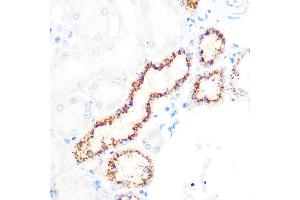 Immunohistochemistry of paraffin-embedded rat kidney using OSR1 Rabbit pAb (ABIN7269080) at dilution of 1:100 (40x lens). (OSR1 antibody)