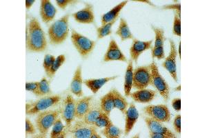 Immunohistochemistry (IHC) image for anti-Annexin A5 (ANXA5) (AA 88-102), (Middle Region) antibody (ABIN3044315)