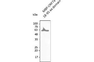 Western Blotting (WB) image for anti-SARS-CoV-2 ORF7a antibody (ABIN7272994) (SARS-CoV-2 ORF7a antibody)