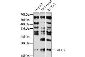 Western blot analysis of extracts of various cell lines, using L antibody (ABIN7268159) at 1:1000 dilution. (LAGE3 antibody  (AA 1-143))
