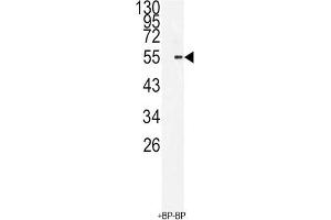 Western Blotting (WB) image for anti-BMI1 Polycomb Ring Finger Oncogene (BMI1) antibody (ABIN3001536)