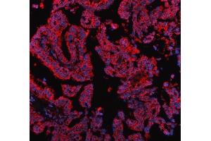 IF analysis of PDK2 using anti-PDK2 antibody (ABIN5693279). (PDK2 antibody  (AA 81-177))