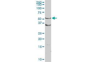 ASL MaxPab rabbit polyclonal antibody. (ASL antibody  (AA 1-464))