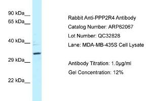 Western Blotting (WB) image for anti-Protein Phosphatase 2A Activator, Regulatory Subunit 4 (PPP2R4) (N-Term) antibody (ABIN971455) (PPP2R4 antibody  (N-Term))
