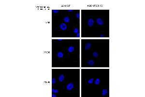 Immunocytochemistry/Immunofluorescence analysis using Mouse Anti-VPS35 Monoclonal Antibody, Clone 10A8 (ABIN6933002). (VPS35 antibody  (PE))