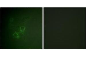 Immunofluorescence analysis of HeLa cells, using AhR (Ab-36) Antibody. (Aryl Hydrocarbon Receptor antibody  (AA 2-51))