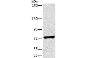 Western blot analysis of K562 cell, using HSD17B4 Polyclonal Antibody at dilution of 1:400 (HSD17B4 antibody)