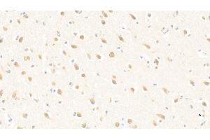 Detection of PURA in Human Cerebrum Tissue using Polyclonal Antibody to Purine Rich Element Binding Protein A (PURA) (PURA antibody  (AA 1-322))