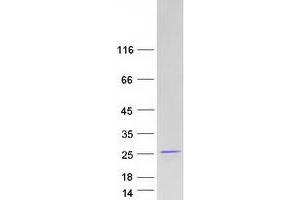 Ring Finger Protein 181 (RNF181) protein (Myc-DYKDDDDK Tag)