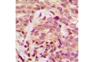 Immunohistochemistry (IHC) image for anti-Inhibitor of kappa Light Polypeptide Gene Enhancer in B-Cells, Kinase gamma (IKBKG) (N-Term), (pSer31) antibody (ABIN7297394)