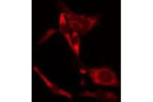 ABIN6275647 staining NIH-3T3 cells by IF/ICC. (PEAK1 antibody  (Internal Region))