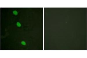 Immunofluorescence analysis of HeLa cells, using CaMK4 (Phospho-Thr196/200) Antibody. (CAMK4 antibody  (pThr200))