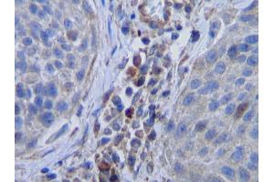 Immunohistochemistry (IHC) image for anti-Colony Stimulating Factor 1 (Macrophage) (CSF1) antibody (ABIN2475421) (M-CSF/CSF1 antibody)