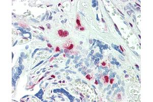 Anti-KLF16 antibody IHC staining of human placenta.
