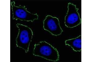 Fluorescent image of A549 cell stained with CD33 antibody at 1:25. (CD33 antibody  (AA 337-364))
