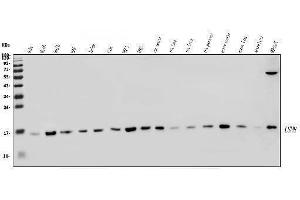 Western blot analysis of LSM8 using anti-LSM8 antibody (ABIN7599579).