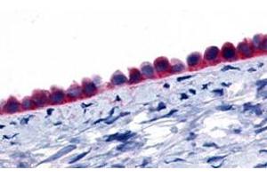 Immunohistochemistry (Formalin/PFA-fixed paraffin-embedded sections) of human ovary, epithelium with GPR133 polyclonal antibody . (G Protein-Coupled Receptor 133 antibody  (Extracellular Domain))