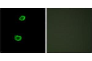 Immunofluorescence analysis of HepG2 cells, using LMTK2 Antibody. (LMTK2 antibody  (AA 651-700))