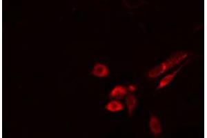 ABIN6274514 staining Hela cells by IF/ICC. (FKRP antibody  (N-Term))