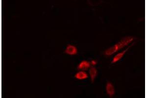 ABIN6274514 staining Hela cells by IF/ICC.