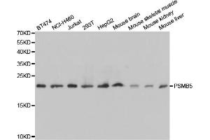 Western blot analysis of extracts of various cell lines, using PSMB5 antibody. (PSMB5 antibody)