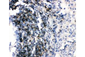IHC-P: CD79b antibody testing of human tonsil tissue (CD79b antibody  (AA 29-229))