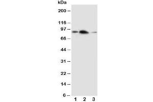 Western blot testing of APLP2 antibody and Lane 1:  rat brain;  2: rat heart;  3: human SMMC-7721 cell lysate (APLP2 antibody  (C-Term))