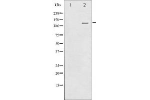 Western blot analysis of RBL2 using MCF7 whole cell lysates (p130 antibody  (C-Term))