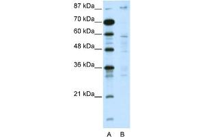 WB Suggested Anti-DMAP1 Antibody Titration:  5. (DMAP1 antibody  (C-Term))