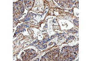 IHC analysis of Collagen III/COL3A1 using anti-Collagen III/COL3A1 antibody (ABIN6719295).