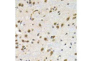 Immunohistochemistry of paraffin-embedded rat brain using LBR antibody at dilution of 1:200 (40x lens). (Lamin B Receptor antibody)
