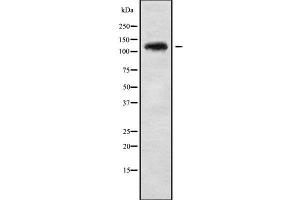 Western blot analysis UBE4A using HepG2 whole cell lysates