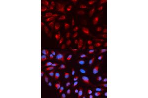 Immunofluorescence analysis of U2OS cell using CTBP1 antibody. (CTBP1 antibody)