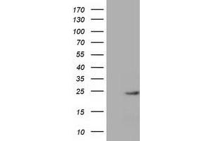 HEK293T cells were transfected with the pCMV6-ENTRY control (Left lane) or pCMV6-ENTRY MOBKL1A (Right lane) cDNA for 48 hrs and lysed. (MOBKL1A antibody)
