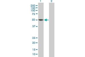 Western Blot analysis of ZCCHC12 expression in transfected 293T cell line by ZCCHC12 MaxPab polyclonal antibody. (ZCCHC12 antibody  (AA 1-402))