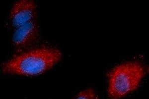 Immunofluorescence (IF) image for anti-Fatty Acid Binding Protein 4, Adipocyte (FABP4) (AA 1-132) antibody (PE) (ABIN5567676) (FABP4 antibody  (AA 1-132) (PE))