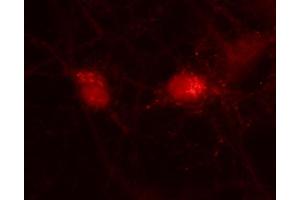 Immunofluorescence labeling of rat hippocampal neurons (dilution 1 : 500). (VTI1A antibody  (AA 2-185))