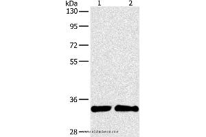 Western blot analysis of A431 and 231 cell, using ARTN Polyclonal Antibody at dilution of 1:350 (ARTN antibody)