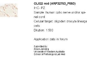 Sample Type: Human Optic Nerve and Spinal CordCellular Target: Oligoden Drocyte Lineage CellsDilution: 1:500 (OLIG2 antibody  (C-Term))