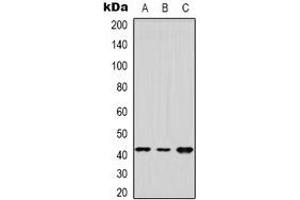 Western blot analysis of DUSP9 expression in Hela (A), HEK293T (B), NIH3T3 (C) whole cell lysates. (DUSP9 antibody)