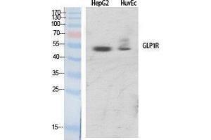 Western Blotting (WB) image for anti-Glucagon-Like Peptide 1 Receptor (GLP1R) (Internal Region) antibody (ABIN3175279) (GLP1R antibody  (Internal Region))