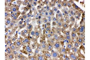 Immunohistochemistry (IHC) image for anti-Catalase (CAT) (AA 344-527) antibody (ABIN4886504)