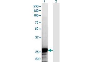 Western Blot analysis of NOL3 expression in transfected 293T cell line by NOL3 monoclonal antibody (M03A), clone 6F5. (NOL3 antibody  (AA 1-208))