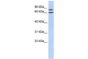 FSIP1 antibody used at 1 ug/ml to detect target protein. (FSIP1 antibody  (Middle Region))