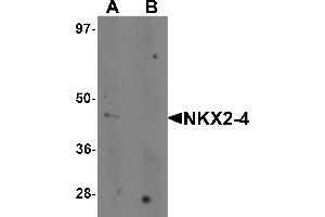Western blot analysis of NKX2-4 in A20 cell lysate with NKX2-4 antibody at 1 µg/mL in (A) the absence and (B) the presence of blocking peptide. (NK2 Homeobox 4 antibody  (Middle Region))