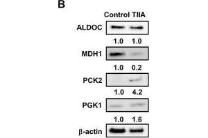 Treatment with TIIA changes the expression of glucose metabolism-related proteins in AGS cells. (ALDOC antibody)