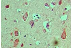 Image no. 1 for anti-Cactin, Spliceosome C Complex Subunit (CACTIN) (AA 460-510) antibody (ABIN960103) (CACTIN antibody  (AA 460-510))