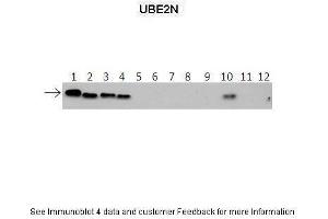 Western Blotting (WB) image for anti-Ubiquitin-Conjugating Enzyme E2N (UBE2N) (Middle Region) antibody (ABIN2777765)
